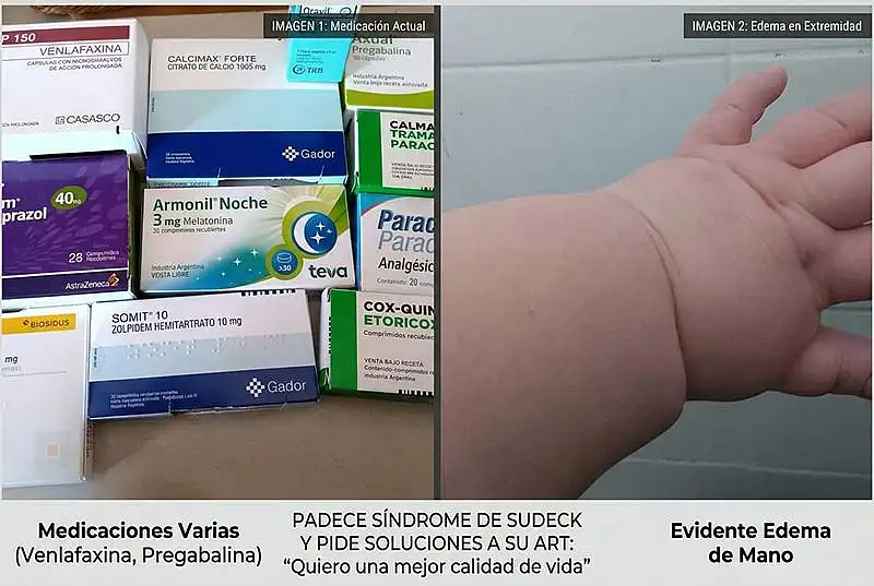Padece enfermedad crónico-dolorosa tras accidente laboral y exige alternativas a su ART: ...